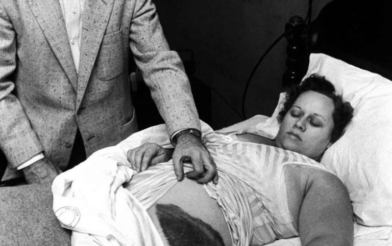 The Unbelievable True Story Of The Only Person To Be Hit By A Meteorite